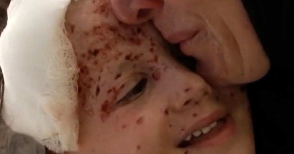 Inside a beirut hospital treating injured children